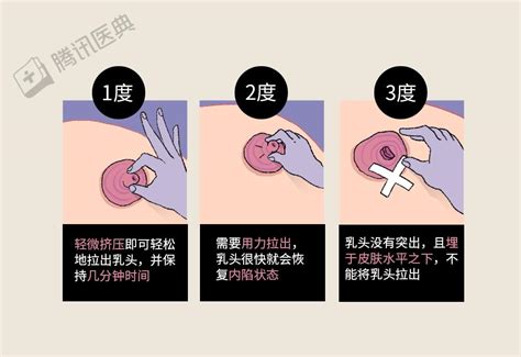 胸上长毛|乳头边上有毛毛正常吗？10 个你需要知道的小问题